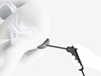 A HOLISTIC HUMAN-CENTERED APPROACH TO COLONOSCOPY: Concept "Clear View"